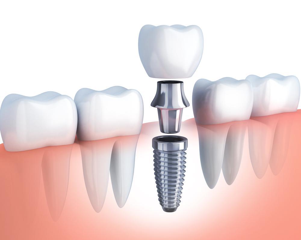 profile